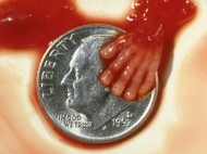 10 Week Abortion (08)