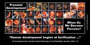GAP Sign - "Prenatal Development"
